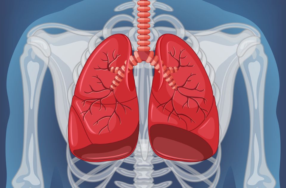 CMRA COPD